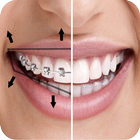 Braces On Photo biểu tượng