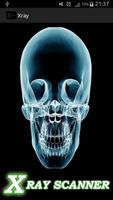 Bone X-ray prank syot layar 3