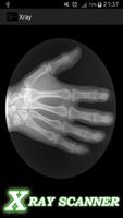 Bone X-ray prank syot layar 1