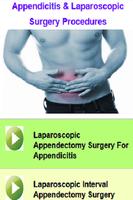 Appendicitis & Laparoscopic Surgery Procedures Affiche