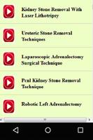 Urology Surgery Procedures captura de pantalla 3