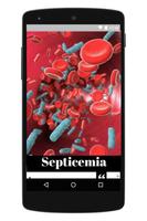La Septicemia o Infección en La Sangre স্ক্রিনশট 3