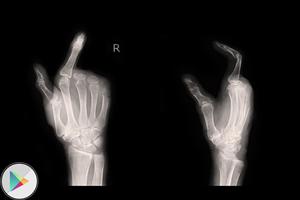 X-Ray Scanner Prank Ekran Görüntüsü 2