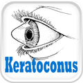 Keratoconus Disease