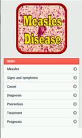 Measles Disease Affiche