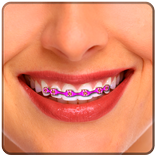 Fake Braces - Photo Editor