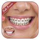 Fake Braces - Face Photo Editor APK