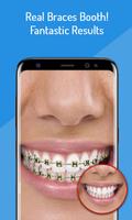 Fake Braces - Face Photo Editor تصوير الشاشة 1