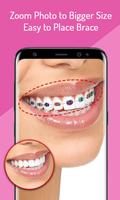 برنامه‌نما Fake Braces - Face Photo Editor عکس از صفحه