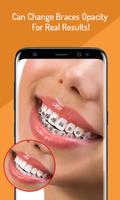 Fake Braces - Face Photo Editor تصوير الشاشة 3