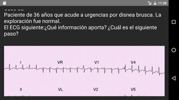 ECG 100 casos prácticos スクリーンショット 3