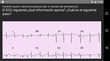 ECG 100 casos prácticos スクリーンショット 2