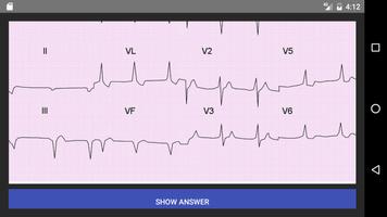 ECG 100 Clinical Cases ภาพหน้าจอ 4