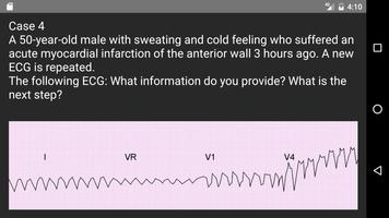 ECG 100 Clinical Cases ภาพหน้าจอ 5