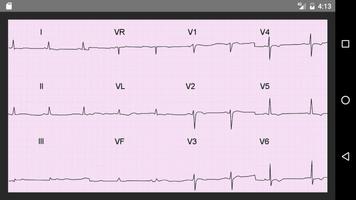 ECG 100 Clinical Cases ภาพหน้าจอ 7