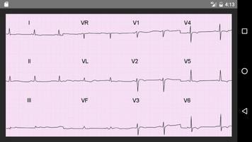 ECG 100 Clinical Cases capture d'écran 1