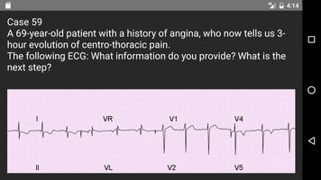 ECG 100 Clinical Cases captura de pantalla 2