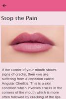 How To Heal Cracked Lips poster
