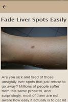 How To Remove Liver Spots screenshot 2