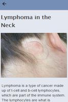 Symptoms Of Lymphoma capture d'écran 1
