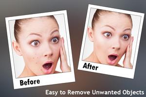 Retouch - Touch to remove content تصوير الشاشة 2