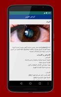 Eye Diseases screenshot 2