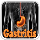 APK Gastritis Disease