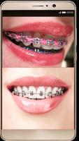 Braces Photo Editor скриншот 2