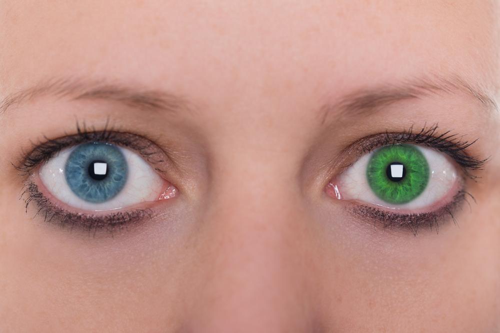 Другой голубой. Гетерохромия зеленый и голубой. Гетерохромия глаз голубой и зеленый. Один глаз зеленый другой голубой. Один глаз синий другой зеленый.