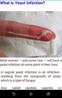 Yeast Infection screenshot 2
