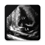 ECHOCARDIOGRAPHY GUIDE