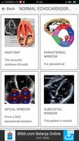 ECHOCARDIOGRAPHY GUIDE Affiche