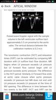 ECHOCARDIOGRAPHY GUIDE capture d'écran 3