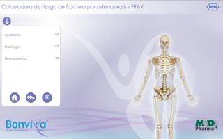 Calculadora FRAX plakat