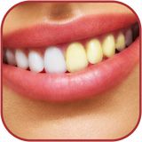 وصفات تبييض الأسنان مجربة icon