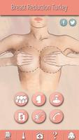 Breast Reduction Turkey Affiche