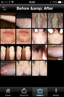 Dermasolve Psoriasis Treatment imagem de tela 1