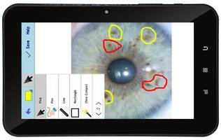 IRIDOLOGIA IRIS SMART 2.0 capture d'écran 1