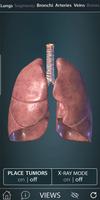 Surgical Anatomy of the Lung 海报