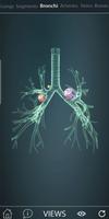 Surgical Anatomy of the Lung 截图 1