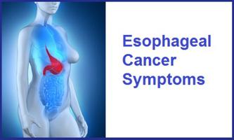 Esophageal Cancer Symptoms Affiche