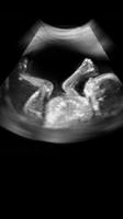 Ultrasound Scanner capture d'écran 3