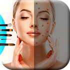 Face Blemish Remover আইকন