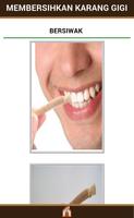 Cara Menghilangkan Karang Gigi syot layar 2