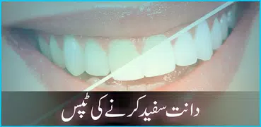 Dant Safed Karnay Ki Tips