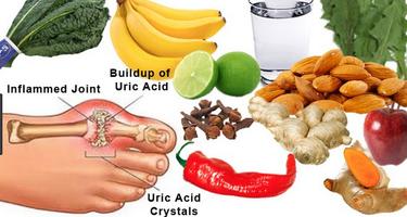 Gout / Uric Acid Diet Affiche