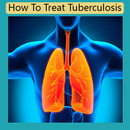 How To Treat Tuberculosis APK