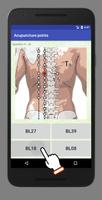 acupuncturepoint ảnh chụp màn hình 2