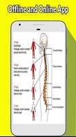 Slipped Disc Exercise Ekran Görüntüsü 2