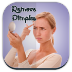 Remove Pimples Guide icône